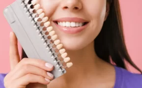 Patient holding dental veneers colour chart sample to her teeth.